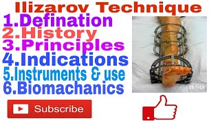 Ilizarov technique height lenghthning externalfixators ringfixators [upl. by Lasonde598]