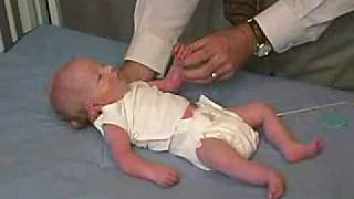 neurology exam newbornabnormal Primitive Reflexes  Moro [upl. by Elac]