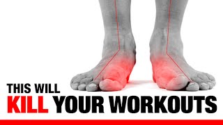 5 Ways Flat Feet “F” Up Your Workouts EXERCISES TO FIX THEM [upl. by Kalin969]