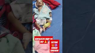 Ventilator 45 day baby by children hospital prayagraj [upl. by Karoly511]