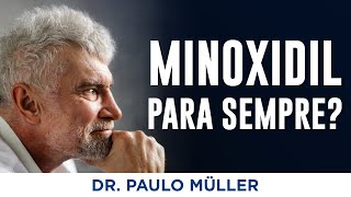 Minoxidil tem que usar para sempre – Dr Paulo Müller Dermatologista [upl. by Eeryn579]