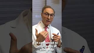 How to Treat Candida at Home Doctors Advice dentist dentalhygiene candida [upl. by Cirle]