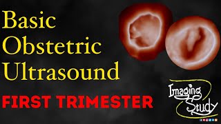 Basic Obstetric Ultrasound First Trimester Pregnancy [upl. by Kosiur378]