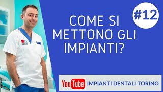 COME SI METTONO GLI IMPIANTI IMPIANTI DENTALI TORINO [upl. by Dedie]