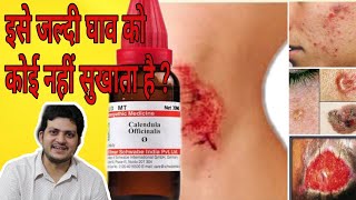 Calendula Mother tincture ka use ghav me kaise kare [upl. by Leaj]