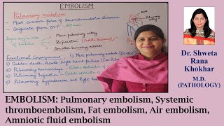 EMBOLISM  Pulmonary Systemic Thromboembolism Fat Air Amniotic Fluid Embolism [upl. by Turk]