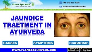 Ayurveda treatment and Medicine for Jaundice  Causes Symptoms amp Diagnosis [upl. by Anyale]