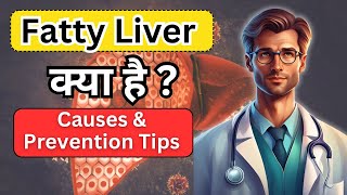 Fatty Liver Explained Causes Symptoms and How to Prevent It [upl. by Rockafellow]