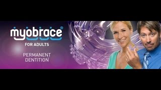 Myobrace for adults [upl. by Aspia]