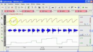 EMG  Derive Integrated EMG [upl. by Nahtannhoj]