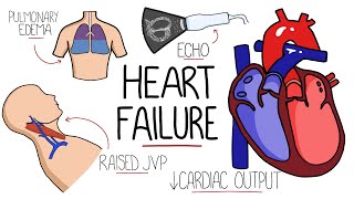 Heart Failure Explained  HFrEF vs HFpEF Systolic vs Diastolic Heart Failure [upl. by Eugaet]