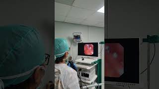 Bronchoscopy or bronkoskopi part 3 [upl. by Werra]