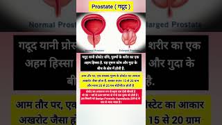 Benign prostatic hyperplasia prostate healthfacts medicalfacts medical medicalcondition health [upl. by Alliuqaj]