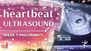 heartbeat ultrasound  week 7 pregnancy [upl. by Htomit]