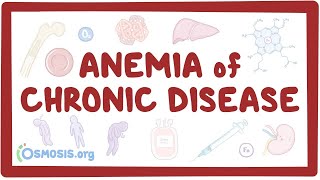 Anemia of chronic disease  an Osmosis Preview [upl. by Oilegor]