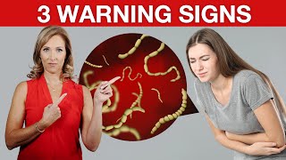 3 Early Warning Signs You Have Parasites 🐛  Dr Janine [upl. by Adav]