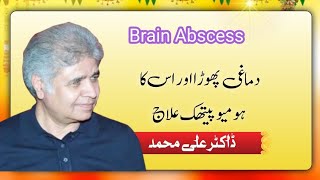 Brain Abscess and its Homeopathic Treatment  Hindi and Urdu  DrAli Muhammad [upl. by Mailliwnhoj]