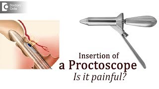 Purpose of proctoscopy How will a doctor insert a Proctoscope  Dr Rajasekhar M R [upl. by Gnouv534]