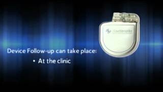 What is an Implantable Cardioverter Defibrillator ICD [upl. by Behlke868]