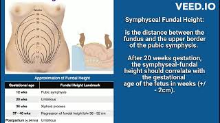 OSCE Symphyseal Fundal Height [upl. by Kcirdlek]