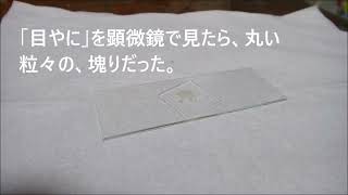 目やにを顕微鏡で見たら丸い粒のかたまりだった。昭和の顕微鏡オリンパスGC ＋ 令和のデジタル接眼レンズ [upl. by Willamina]