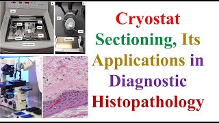 Cryostat Sectioning Its Applications in Diagnostic Histo 5th MLS HISTOTECHNOLOGY – 2 Cytology [upl. by Eicats]