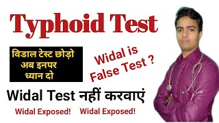 Widal Test In Hindi  Enteric Fever Test Report  विडाल टेस्ट रिपोर्ट नहीं Is False Positive test [upl. by Elleirda]