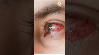 short dexcin eye drops uses and sideeffects  eye flue drop short [upl. by Yeoz]