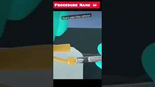 catheterization procedure 3d animation।।catheterization3danimation shorts [upl. by Lashar870]