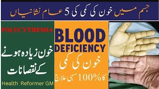 Anemia causessymptoms and treatement urdu hindi Khoon ki kami ka ilagHow to improve hemoglobin [upl. by Enirehs]