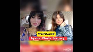 Omg Bollywood Movie Wanted Actress Ayesha Takia Plastic surgery look😱ytviralvideopreetyshorts20 [upl. by Gayleen827]