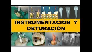 quotINSTRUMENTACION Y OBTURACIÓNquot por el Dr Nestor Jaime [upl. by Miyasawa]