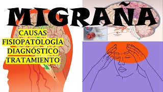 MIGRAÑA CAUSAS SÍNTOMAS FISIOPATOLOGÍA DIAGNÓSTICO Y TRATAMIENTO [upl. by Gwenore]