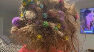 6YearOld Gets 150 Bunchems Velcro Balls Stuck in Her Hair [upl. by Berstine304]