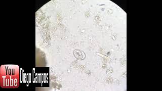 Ancylostoma duodenale egg [upl. by Cayla]