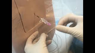 Neuraxial Task Trainer Demonstration  Epidural Anesthesia [upl. by Nauqram723]