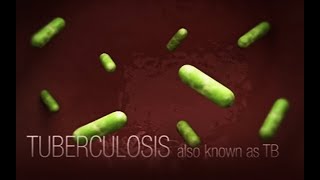 CDC Tuberculosis TB Transmission and Pathogenesis Video [upl. by Shamus]