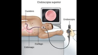 Endoscopía lo que debes saber de esté estudio [upl. by Ameekahs]