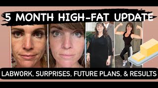 High Fat FiveMonth Update from a 13Year Carnivore [upl. by Razal696]