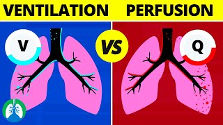 VentilationPerfusion VQ Ratio  Quick Medical Overview [upl. by Fredella]