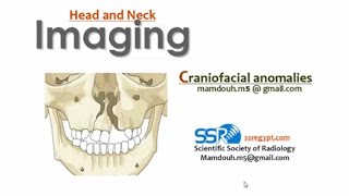 Imaging of craniofacial anomalies DRE Prof Mamdouh Mahfouz [upl. by Norad]