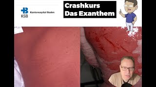 KSB Dermatologie Kurs 4 das Exanthem [upl. by Harmony]