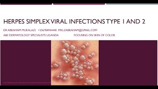 HERPES SIMPLEX VIRUS 1 amp 2 INFECTIONSeducation funny skincondition std skindisease [upl. by Philcox]