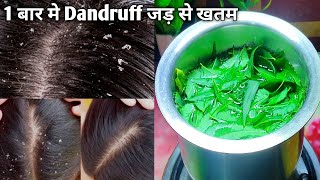 डैंड्रफ हटाने का सबसे आसान घरेलु तरीका  How to Treat Dandruff at Home  Dandruff Removel Remedy [upl. by Awra826]