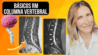 Resonancia Magnética de Columna Guía Rápida para Principiantes [upl. by Crawford25]