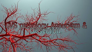 CVS pathology lecture Aneurysm and dissection [upl. by Maitland]