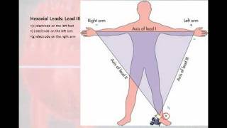 12 Lead Interpretation Part 1 Introduction to the 12 Lead EKG [upl. by Eimas]