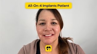 AllOn4 Fixed Teeth in Los Gatos CA  Successful Patient Story [upl. by Llerret653]