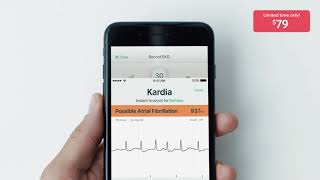 KardiaMobile by AliveCor  79 Limited Time Offer [upl. by Ynagoham579]