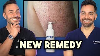 Keratosis Pilaris Crepey Skin New Product Alert from Remedy Science 🚨 [upl. by Ezekiel]